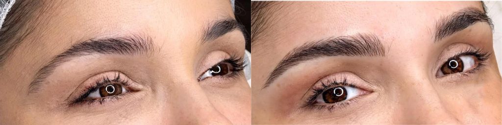 Service 2 Permanent-Line Will Leave You With A No-Fuss,Wake-Up Beautiful Face